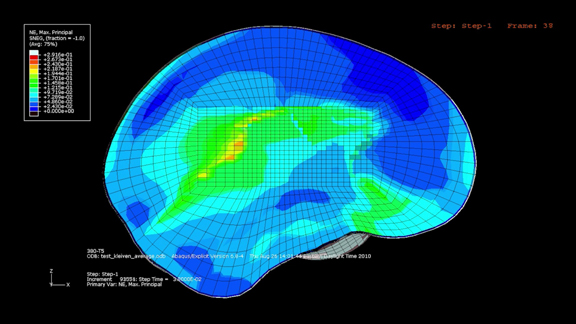 This image shows a simulation of the stresses on the brain based on game data captured using Riddell’s HITS system of helmet sensors (image courtesy of Intel).