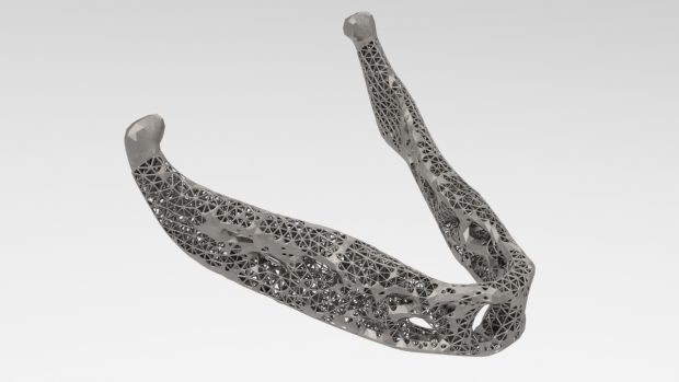 Inspire 2018 debuts functionality that enables design engineers to generate optimized lattice as well as mixed solid-lattice structures that can be exported for 3D printing readily. Shown here is a mixed solid-lattice optimization of a prosthetic human jaw. Image courtesy of Altair Engineering Inc.