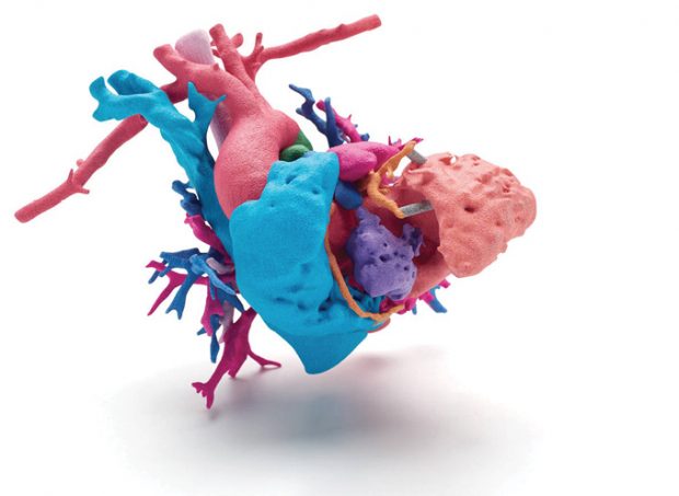 A full-color, 3d-printed model of a human heart used to enhance presurgical planning. Image courtesy of HP; data courtesy of Phoenix Children’s Hospital; Heart of Jemma.