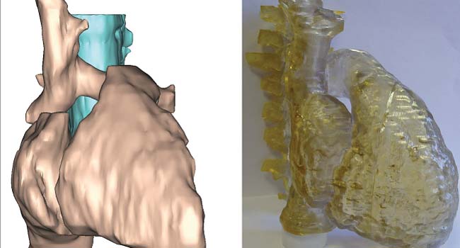 Analysis Aids in Heart Valve Design