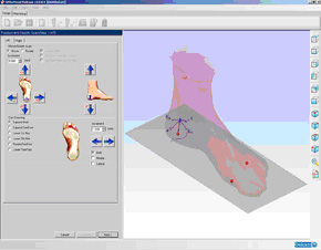 Delcam CRISPIN Launches New Version of Orthotics Software